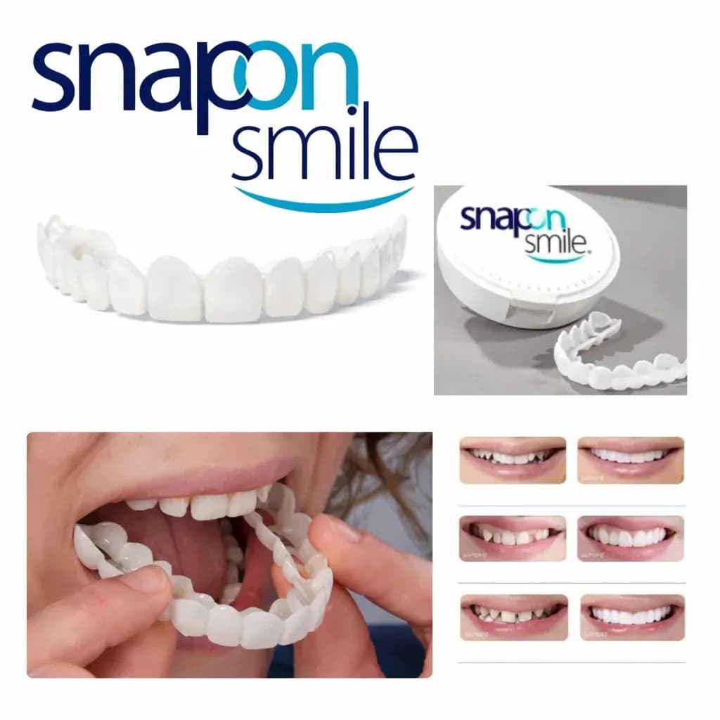 Знімні вініри для зубів Snap On Smile на 2 щелепи • Накладні вініри на верхню та нижню щелепу для красивої усмішки - зображення 1